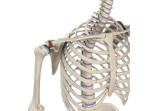 Acromioclavicular Joint Stabilisation