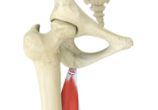 Proximal Hamstring Surgery